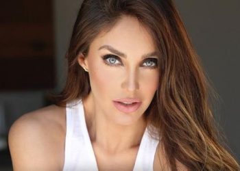 Anahí sufre accidente; se perfora el tímpano antes de su gira RBD