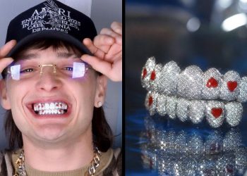 Deslumbra Peso Pluma con su dentadura millonaria