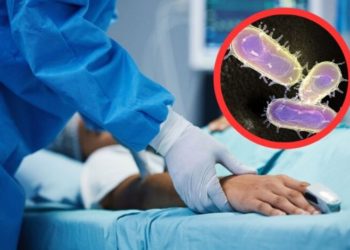 Fallece hombre por peste bubónica en EU