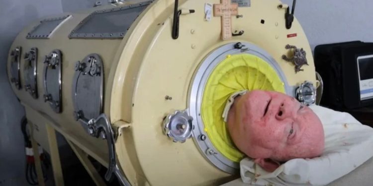 Fallece Paul Alexander, conocido como el hombre del pulmón de acero a los 78 años