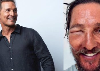 Matthew McConaughey quedó irreconocible tras una picadura de abeja