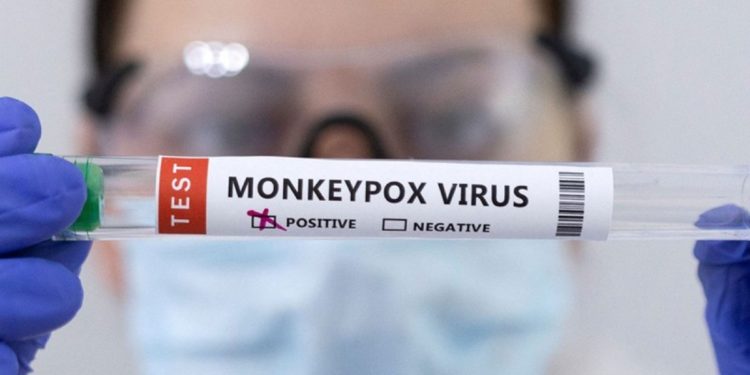 Aumentan a 61 casos por viruela del mono en México