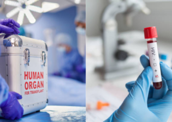 Seis personas dan positivo de VIH al recibir transplante de órganos infectados en Brasil