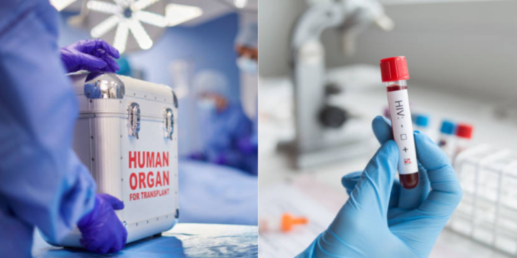Seis personas dan positivo de VIH al recibir transplante de órganos infectados en Brasil
