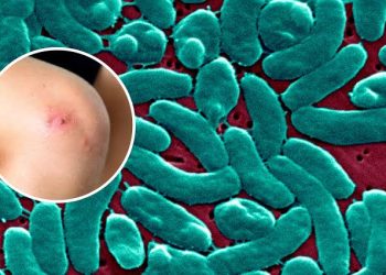 Alertan por bacteria “come carne” tras ocho muertes en EE.UU.