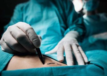 Muere joven en Monterrey durante cirugía estética; Fiscalía confirma perforación de órganos