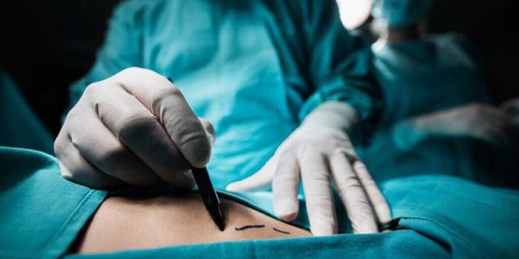 Muere joven en Monterrey durante cirugía estética; Fiscalía confirma perforación de órganos