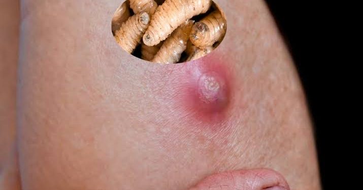 Intensifica Salud Tabasco campaña contra el gusano barrenador en humanos