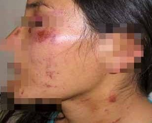 Violencia Doméstica en Ocozocoautla