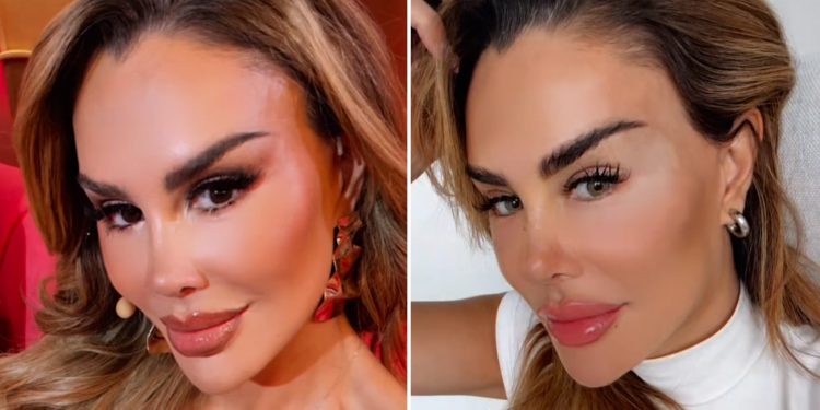 Ninel Conde se Somete a Cirugía para Cambiar el Color de sus Ojos