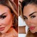 Ninel Conde se Somete a Cirugía para Cambiar el Color de sus Ojos