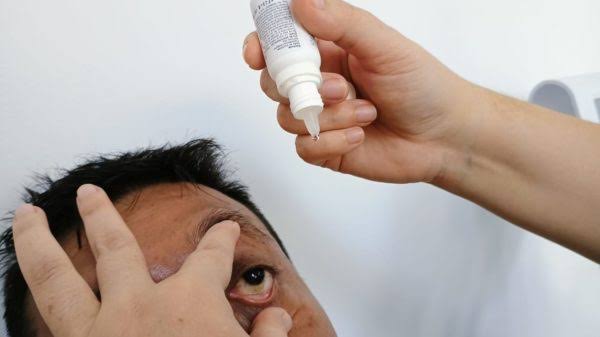 ¡Alerta roja por conjuntivitis en la Península! Superan los 3 mil contagios mientras Campeche frena el avance del virus