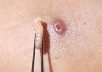 Campeche reporta nueve casos de miasis por gusano barrenador en 2026; descartan riesgo epidemiológico